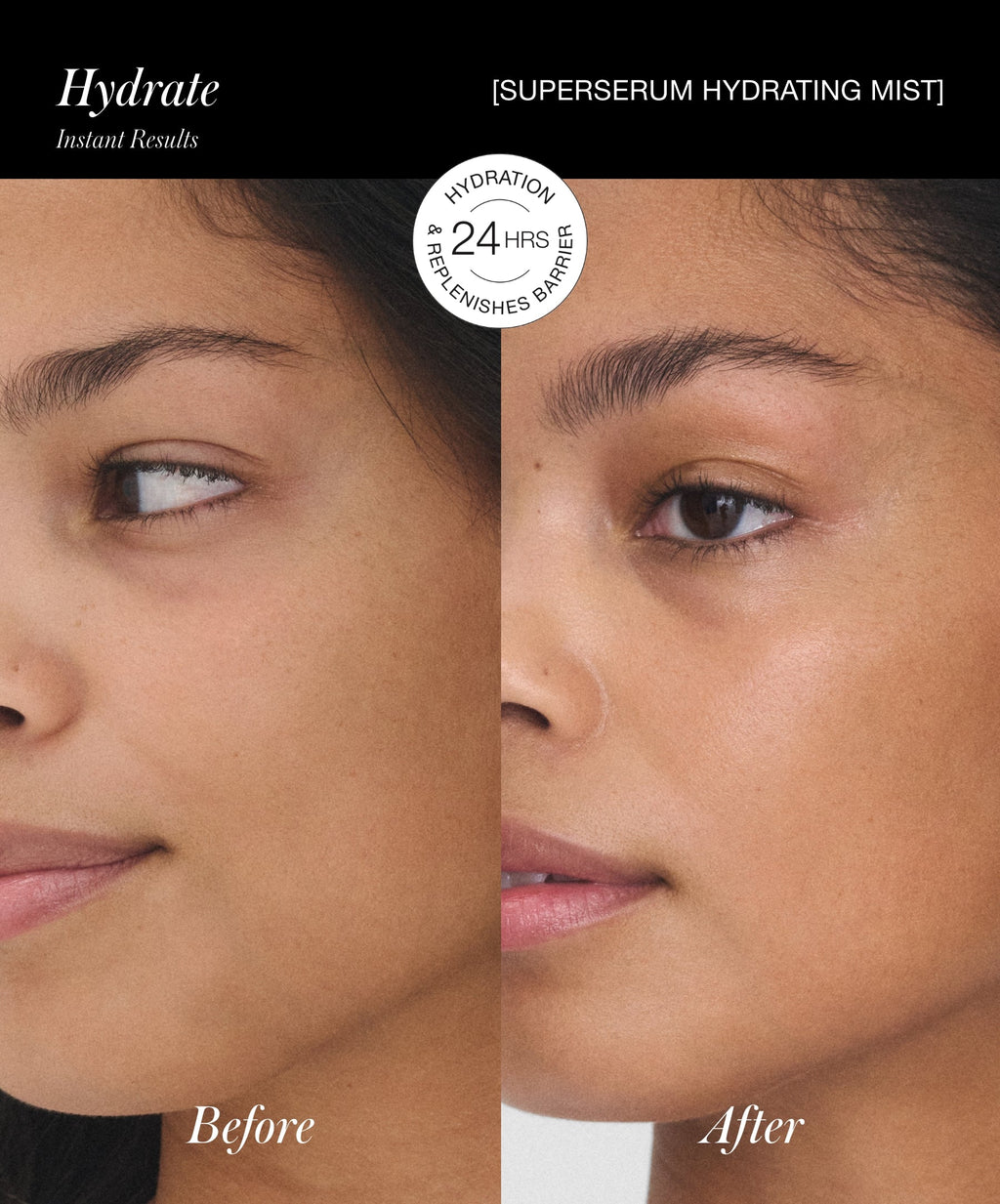 SuperSerum Hydrating Mist Daily Skin Care for Moisture and Comfort
